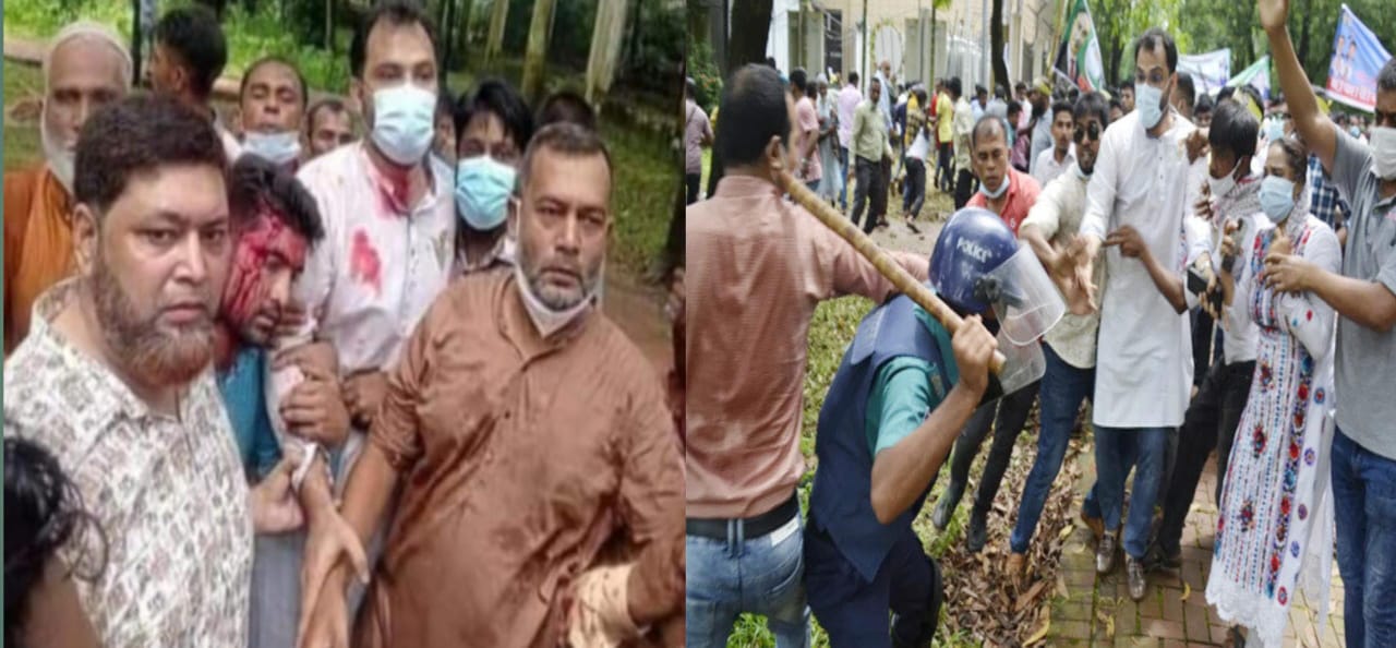 বিএনপি নেতা আমিনুল হক ও ছাত্রদল নেতা কাওছার মল্লিকসহ আহত হয় অর্ধশত